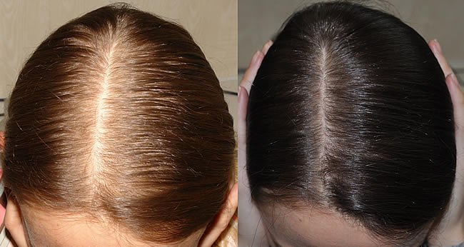 Эти три ингредиента остановят выпадение волос и восстановят их силу и блеск за один раз!